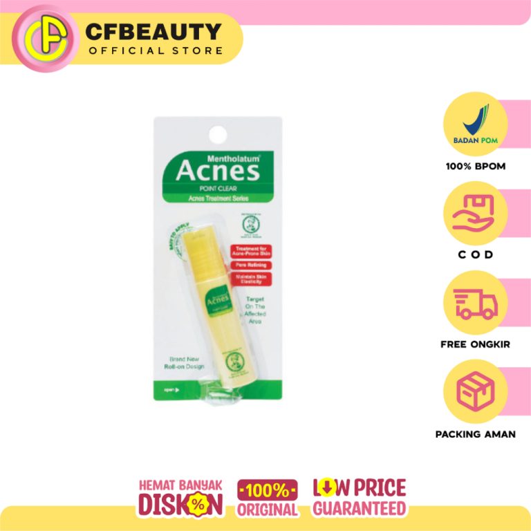 Acnes Acnes Point Clear