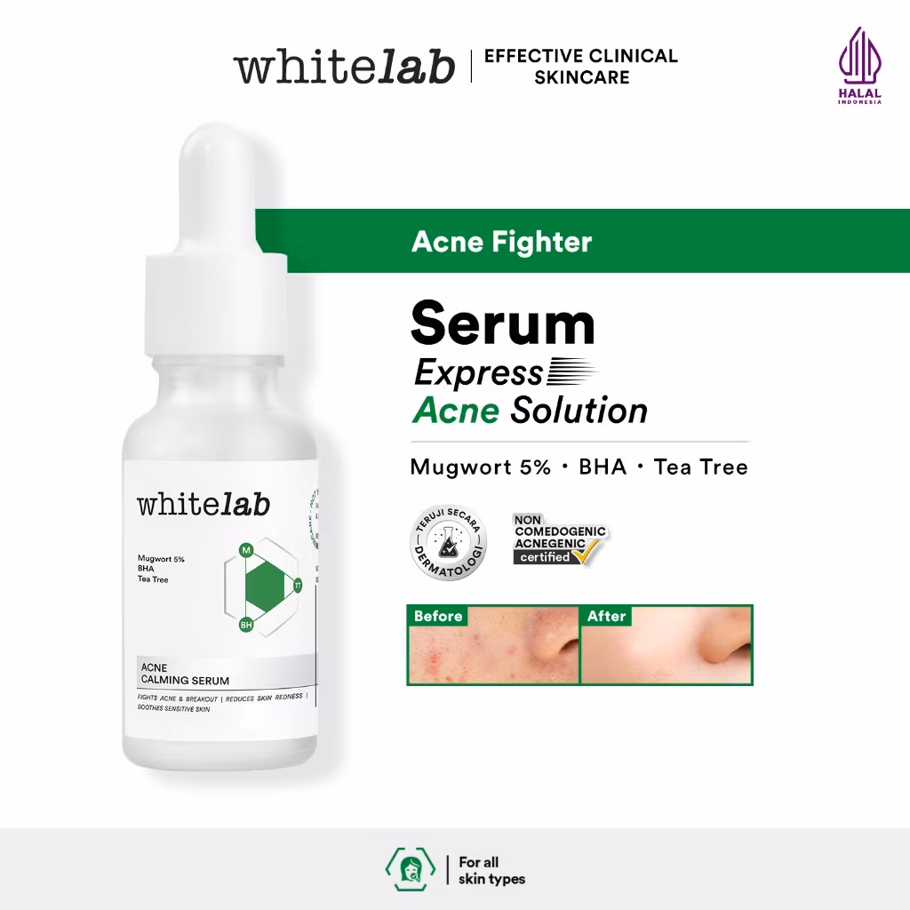 Whitelab Acne Calming Serum