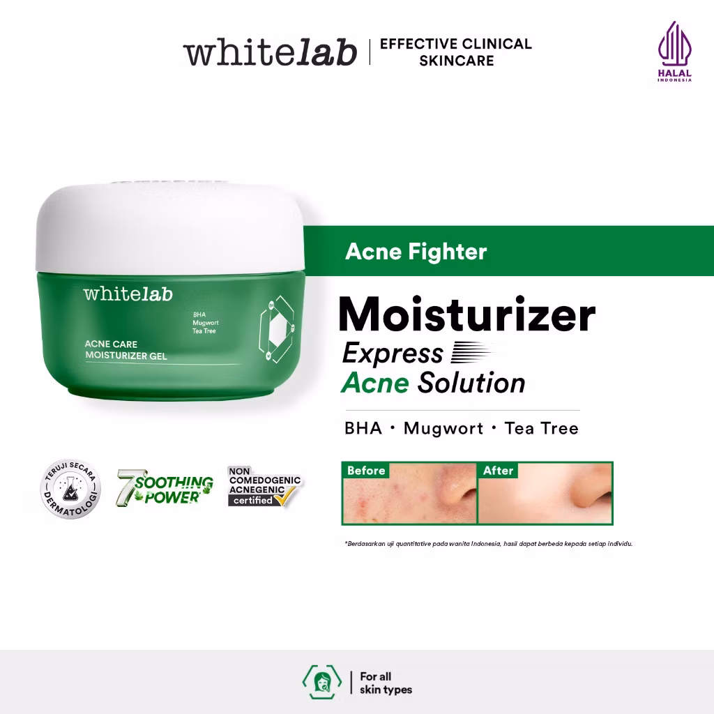 Whitelab Acne Care Moisturizer Gel 20g